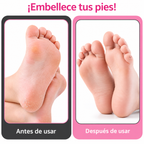 Pulidor de Callos Eléctrico Profesional – Pies Suaves y Renovados en Minutos