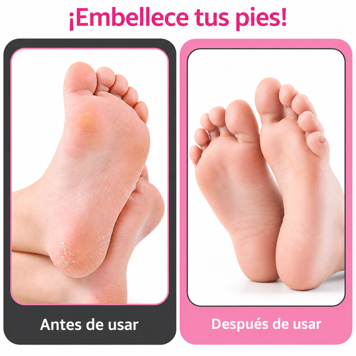 Pulidor de Callos Eléctrico Profesional – Pies Suaves y Renovados en Minutos
